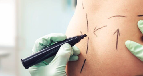 Quando Evitar a Cirurgia Plástica? Casos em que o Procedimento Não É Recomendado
