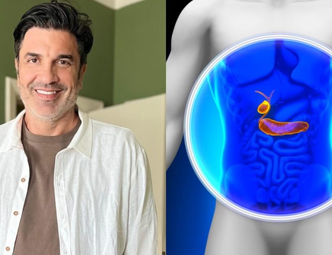 Entenda o caso do apresentador Edu Guedes: “O câncer de pâncreas é uma doença complexa, já que não dá avisos e não tem exame de rastreamento” , alerta médico da Kora Saúde